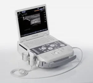 Global Medical Imaging - Acuson P300 - 124329 - Ultrasound System Acuson P300 Portable Dicom With Ecg Cable, 15 Inch Xvga Lcd Monitor, 1024 X 768 Monitor Resolution, Trackball, Cp Back-lighting, 1 Hour And 20 Min Battery, 2 Cm Minimum Depth Of Field, 36 C