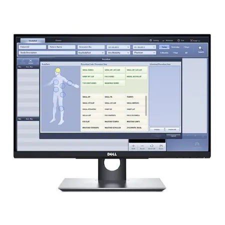 Rayence - V0800013 - Imaging Monitor Touch Screen For Use With X-ray System