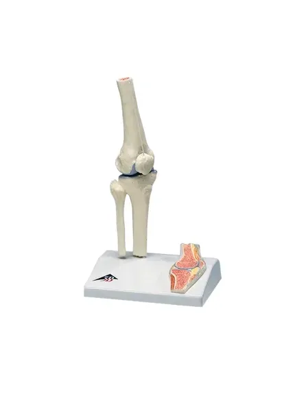 Fabrication Enterprises - 12-4518 - Anatomical Model - mini knee joint with cross section of bone on base